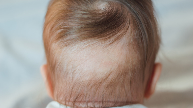 Baby with bald spot