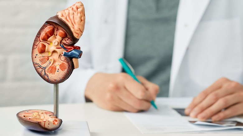 urologist examining kidney stones