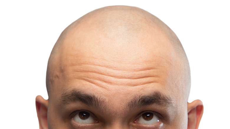man with shaved head looking up 