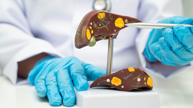 extensive liver scarring and fibrosis