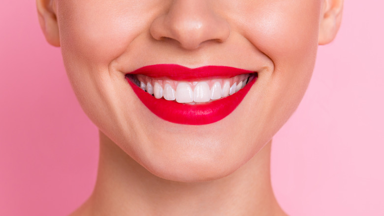 woman smiling showing off perfect white teeth 