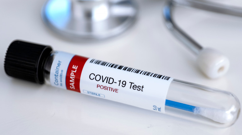 Positive COVID-19 test tube result 