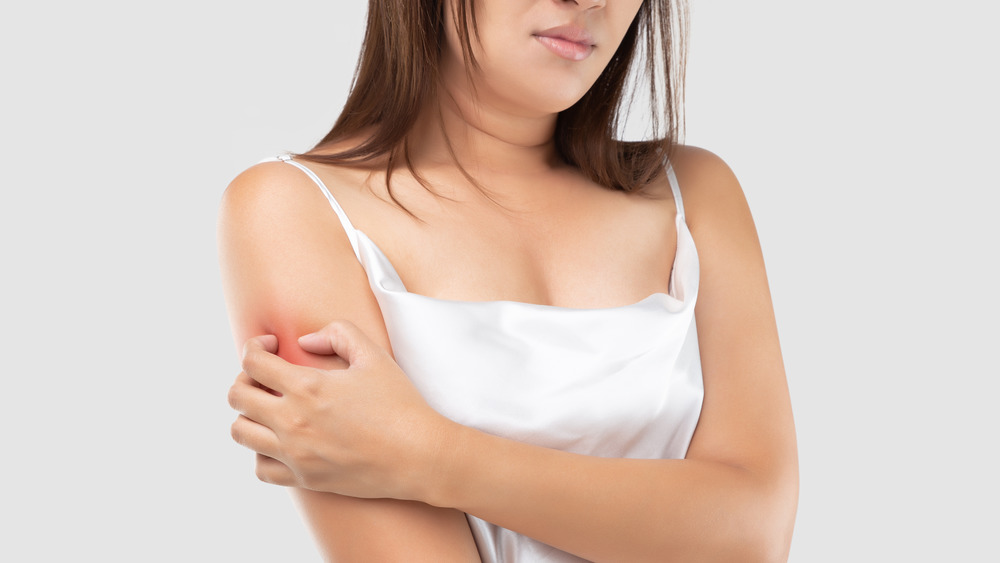 Woman scratching upper arm