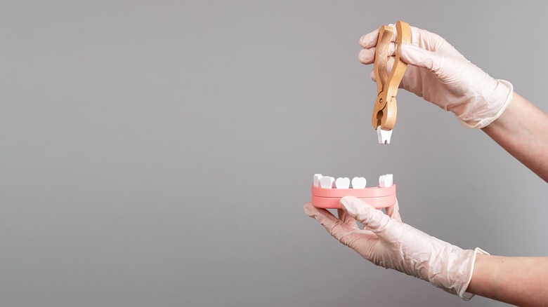 hands pulling wisdom teeth
