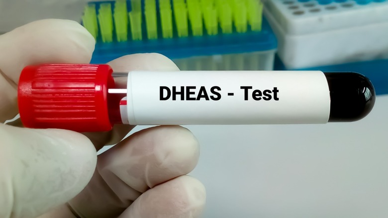 dhea test blood vial