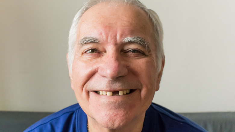 man smiling with missing tooth