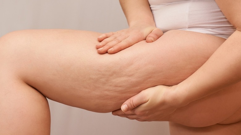 woman squeezing thigh to show cellulite