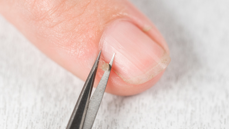 Trimming a hangnail