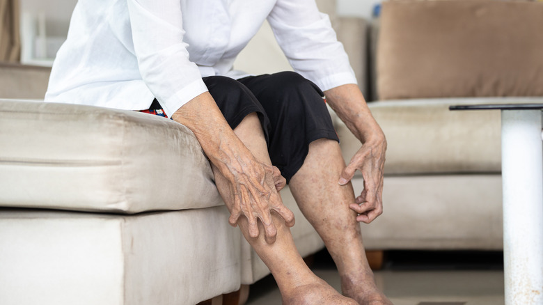 Elderly person scratching legs