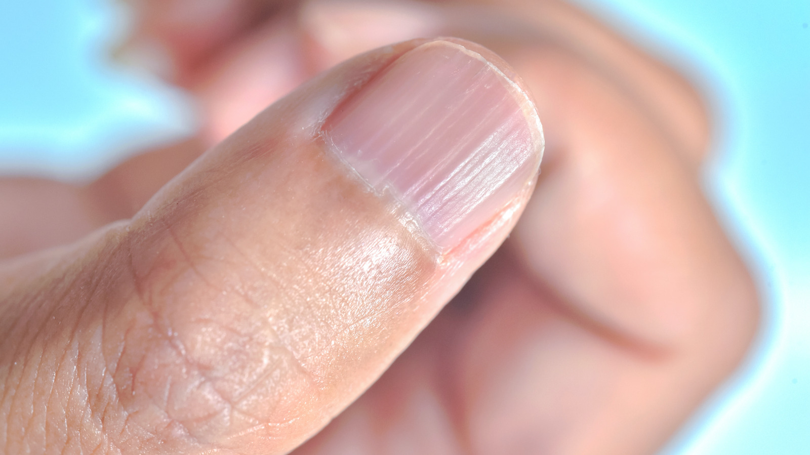 White Spots on the Nails: Causes and More