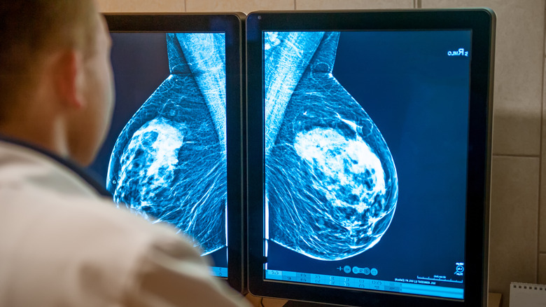 mammogram results