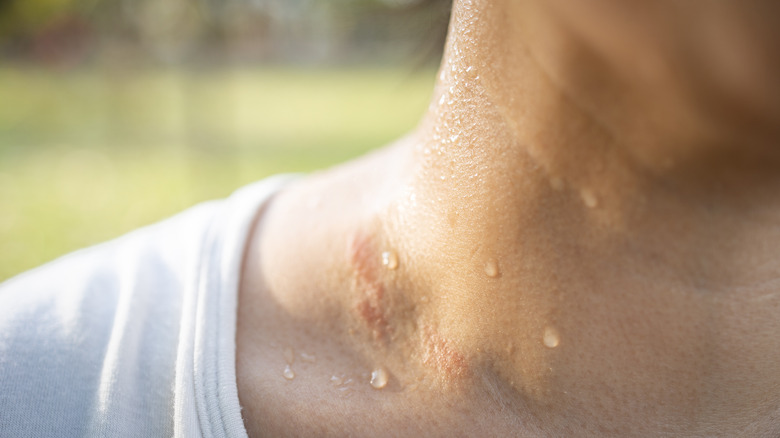 Sweat on woman's neck