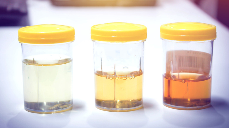 Urine samples on white table