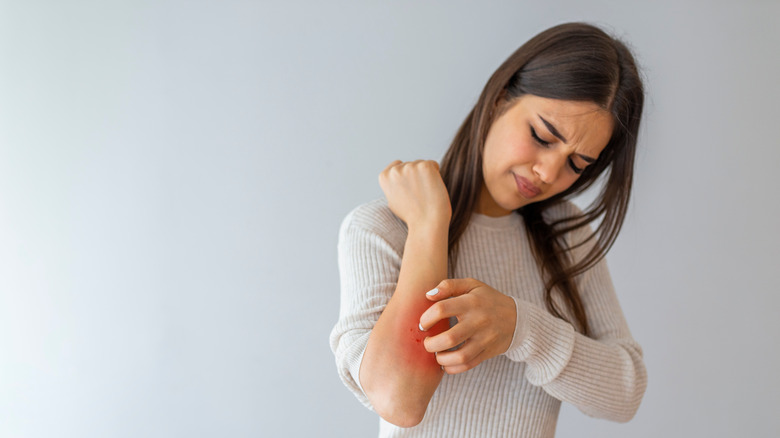 Woman scratching her arm