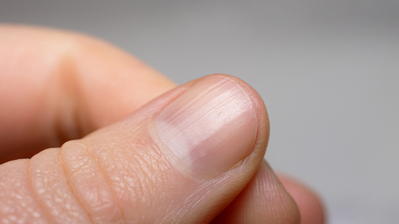 What S Really Under Your Dirty Fingernails