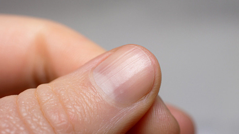 Short fingernails
