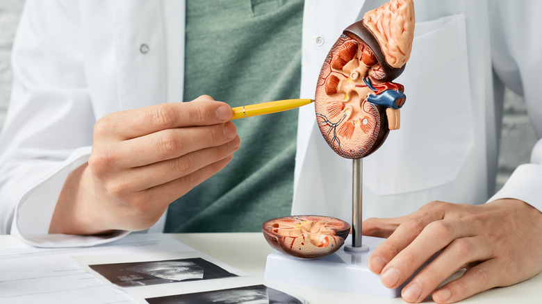 doctor pointing at kidney model