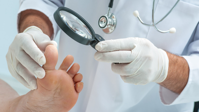 dermatologist examining nails