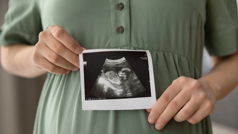 Pregnant mom with ultrasound photo