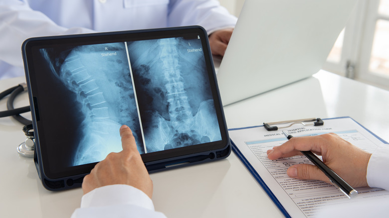 doctor examining lumbar spine digital image