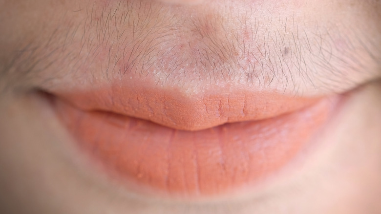close up of female upper lisp with hirsutism