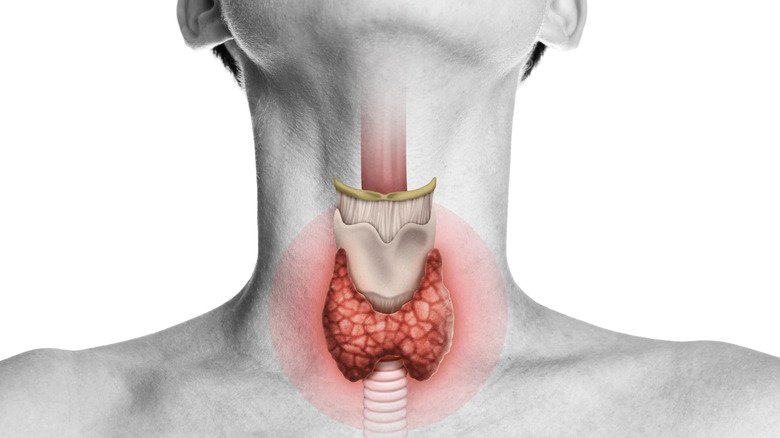 graphic image of thyroid glands