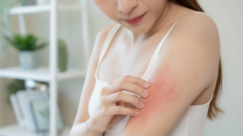 woman itching rash