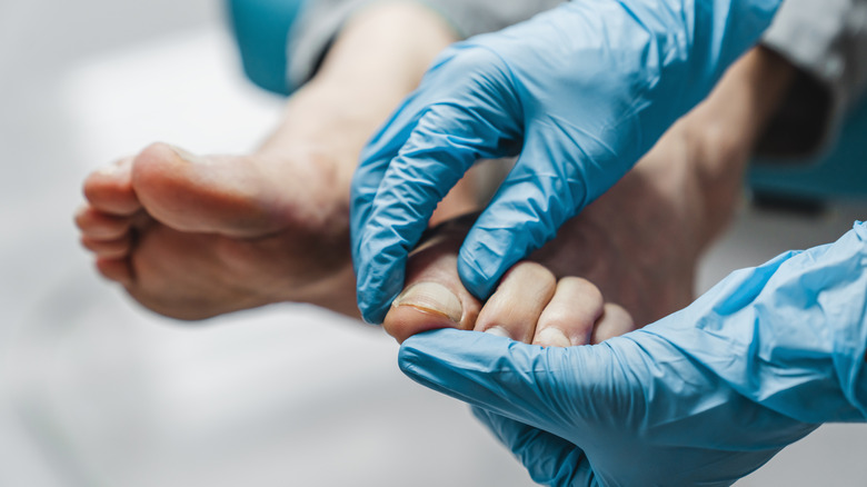 Gloved hands examining dry feet