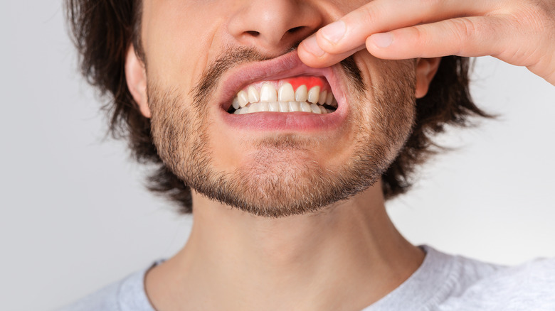 man pushing gum up