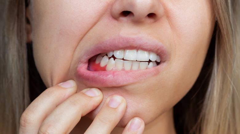 woman showing bleeding gums