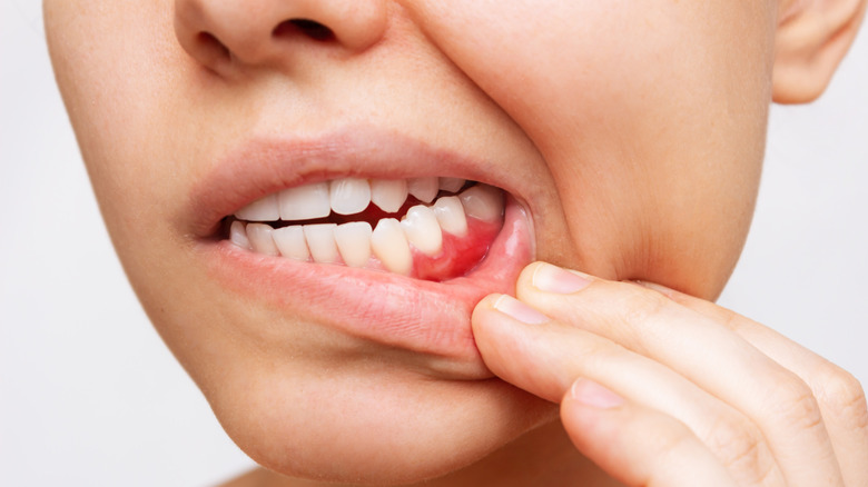 woman looking at her teeth for cavities