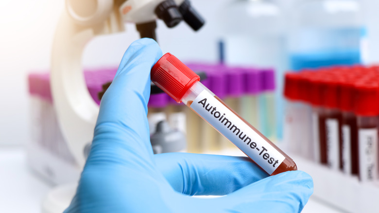 Autoimmune test