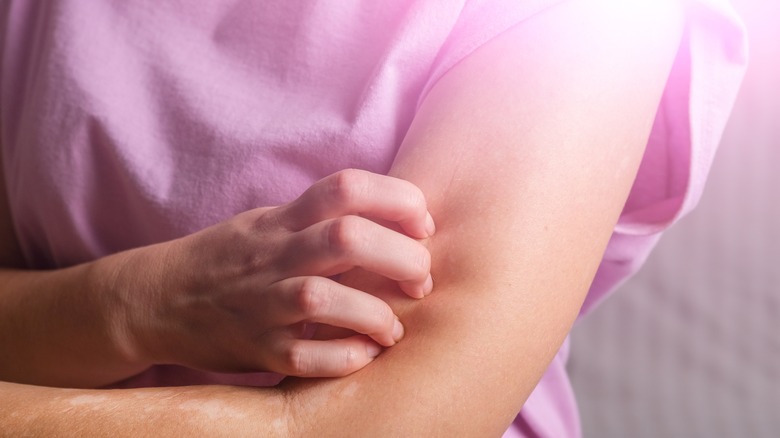 woman itching her arm