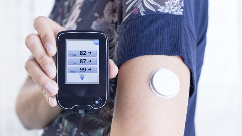 arm with continuous glucose monitor