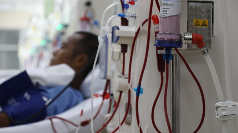 A dialysis treatment 