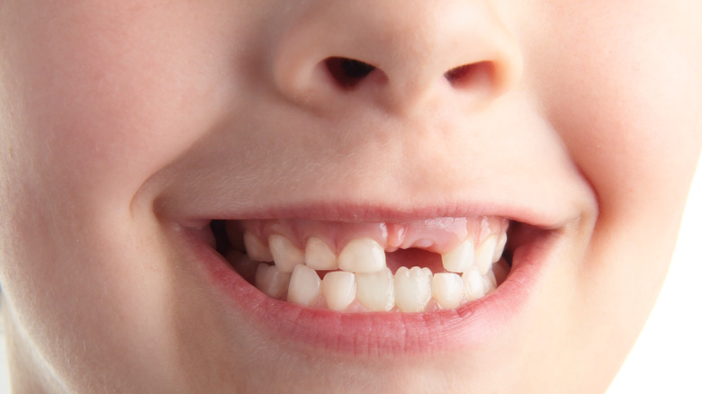close-up of girl with missing tooth