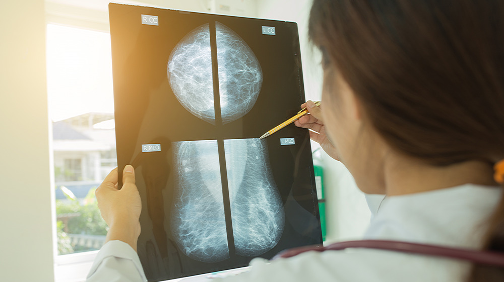 mammogram images