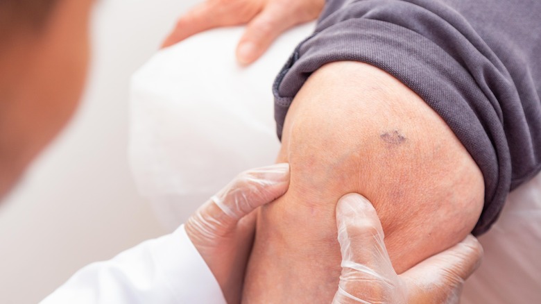 doctor examining patient's knee