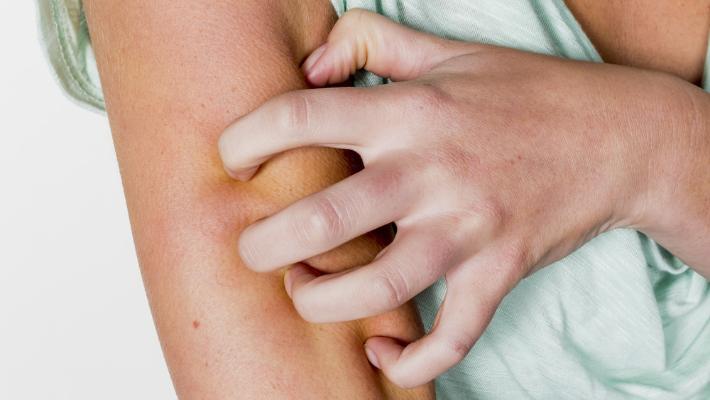 Woman scratching itchy arm