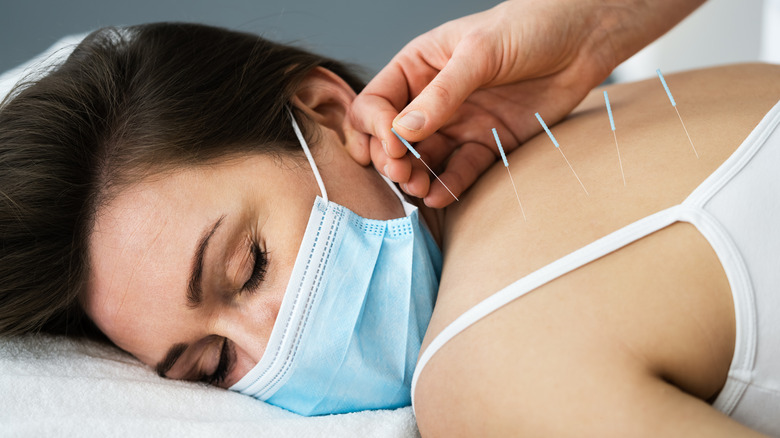 Person wearing mask receiving acupuncture