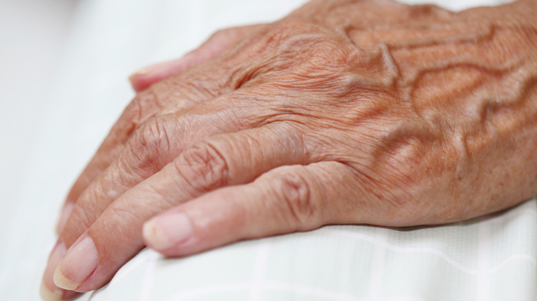 Close up on hand with bulging veins 