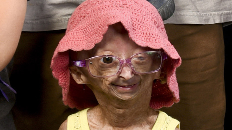 Adalia Rose attends an event with her family